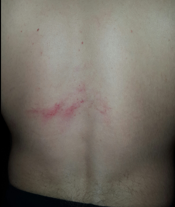 Photo of complainant’s torso